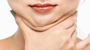1 हफ्ते में चेहरे की चर्बी कैसे कम करें? | How To Reduce Face Fat In Hindi