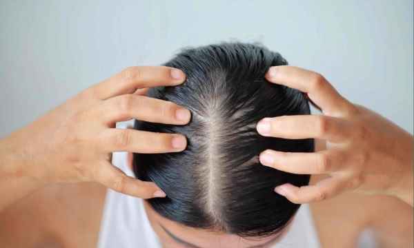 How to Control Hair Loss